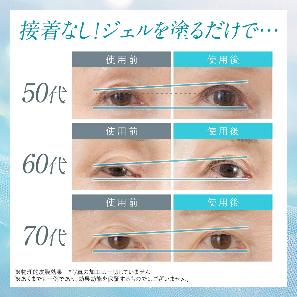 楽天市場】【10%OFFクーポン配布中】まぶた 引き上げ ジェル 整形膜