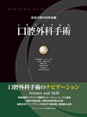 楽天市場】イラストでみる口腔外科手術 第2巻の通販