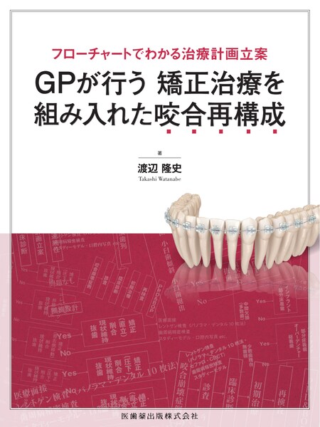 GPがアライナー矯正を行うときに外せないポイントをやさしく症例に沿っ