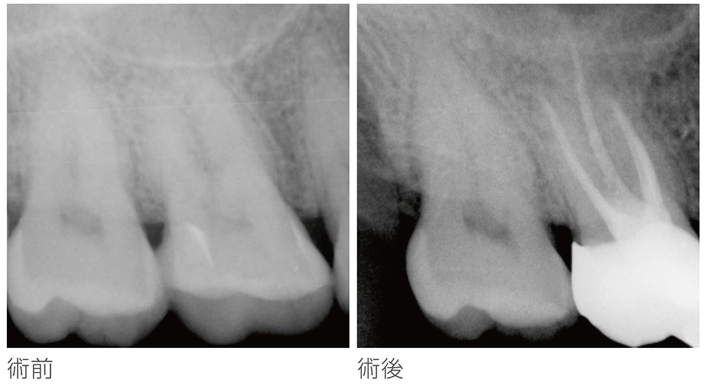 TRZX2Plus_feature03_case2_jp.