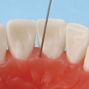 口腔外科実習用顎模型 [P15FE-OOP.1](FE咬合器つき)｜株式会社ニッシン