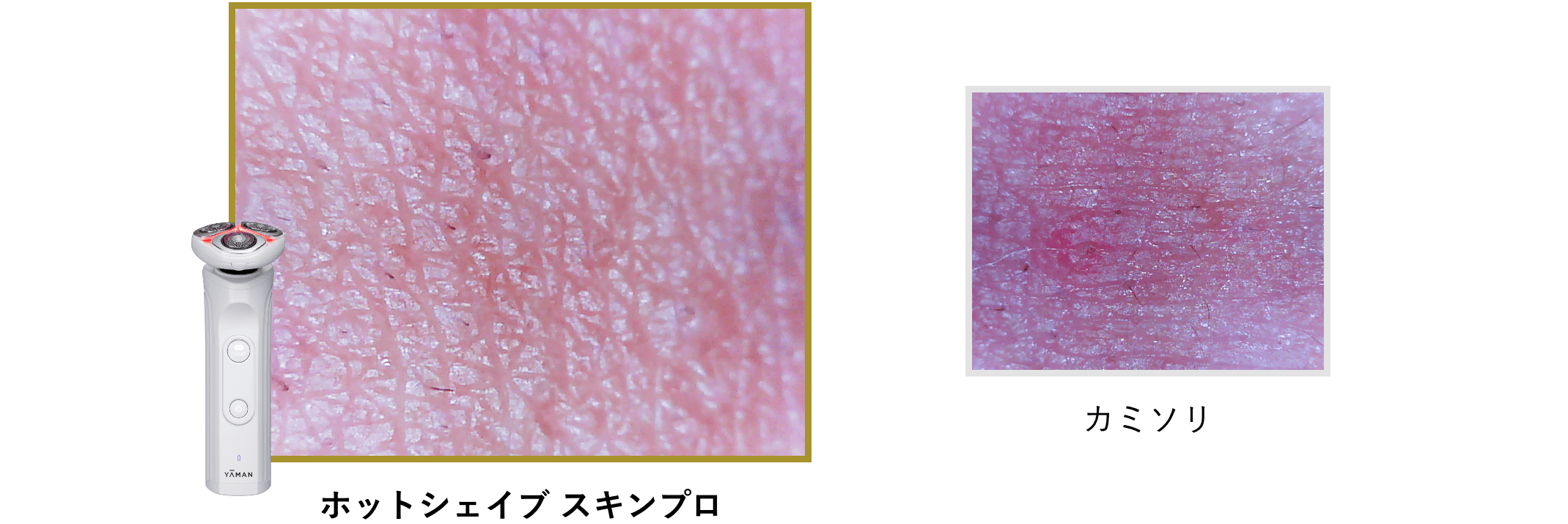 ホットシェイブ スキンプロ』温めて剃る、使うたび、美肌。 | 敏感肌用