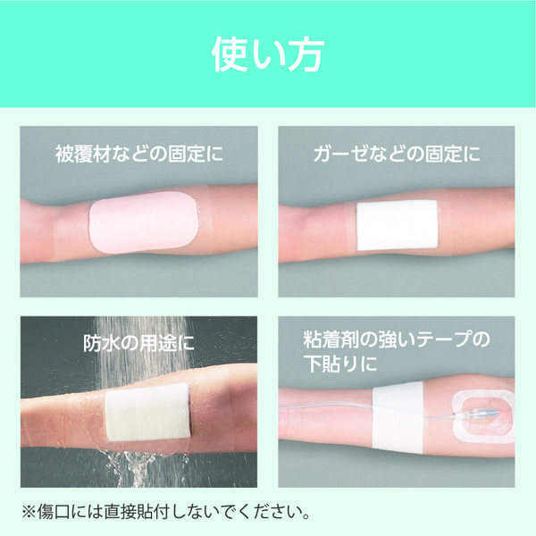 ニトムズ 優肌パーミロール Lite L34R15 1巻 フィルムドレッシング