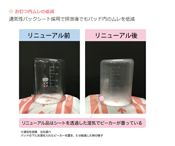 アテント Sケア軟便安心パッド 20枚入 大人用紙おむつ 尿取りパッド