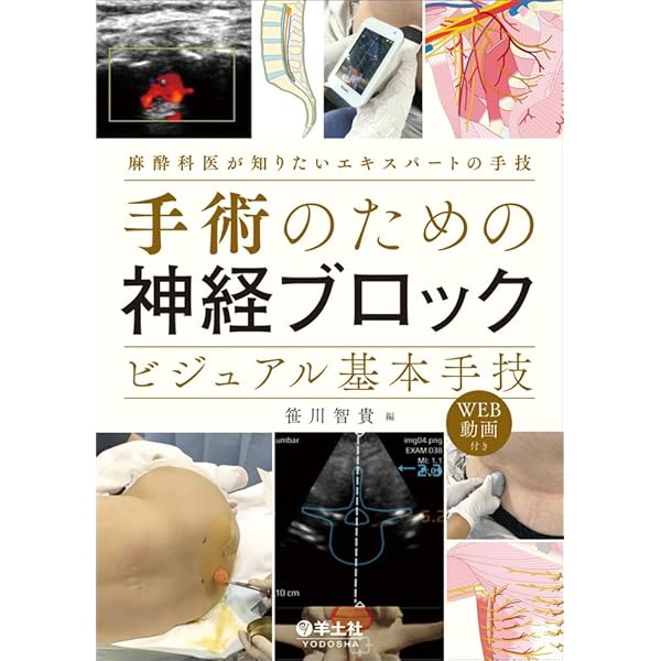 Amazon.co.jp: 最新主要文献とガイドラインでみる 麻酔科学レビュー