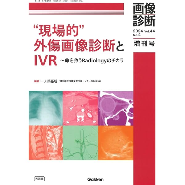 腹部血管のX線解剖図譜 |本 | 通販 | Amazon