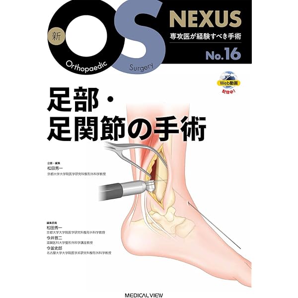 小児の骨折と手術［Web動画付］ (新OS NEXUS) | 大谷 卓也 |本 | 通販