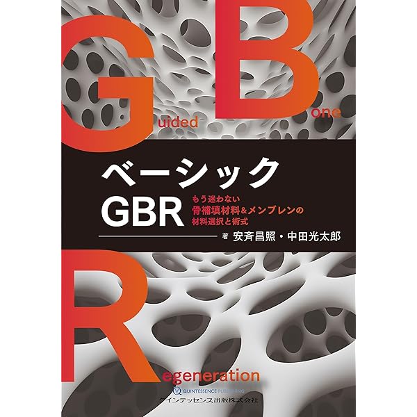 Vertical 2 骨造成: 垂直的および水平的歯槽堤増大術の完成形 | Istvan