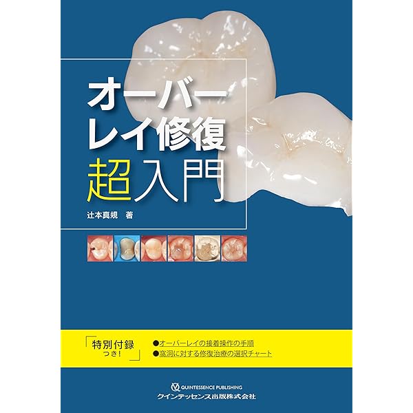 1リテーナーオールセラミック 接着ブリッジ臨床ガイド | 大谷一紀 |本