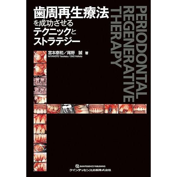 Amazon.co.jp: イラスト・写真・動画で学ぶ! 低侵襲 歯周組織再生療法