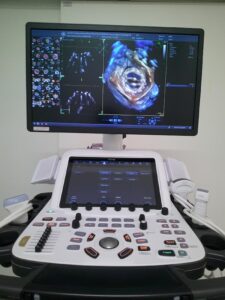 経食道心エコー図検査 | 病院概要 | 沼田脳神経外科循環器科病院