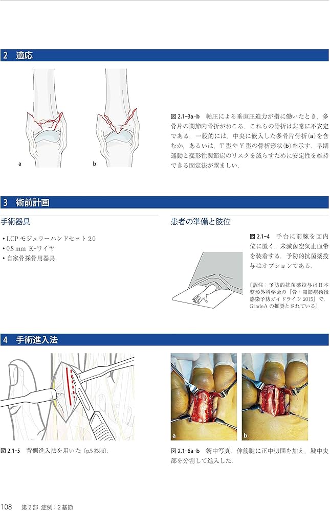 Amazon.co.jp: AO法骨折治療 Hand (AOTRAUMA) : 田中 正: 本