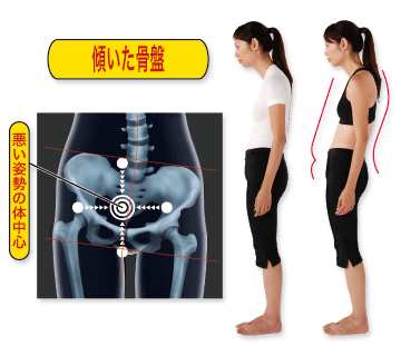 送料無料/ヘルスパワー バランサー バンド/股関節保持バンド グラつく