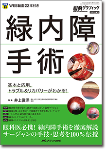 緑内障手術 | オンラインストア｜看護・医学新刊・セミナー｜メディカ出版