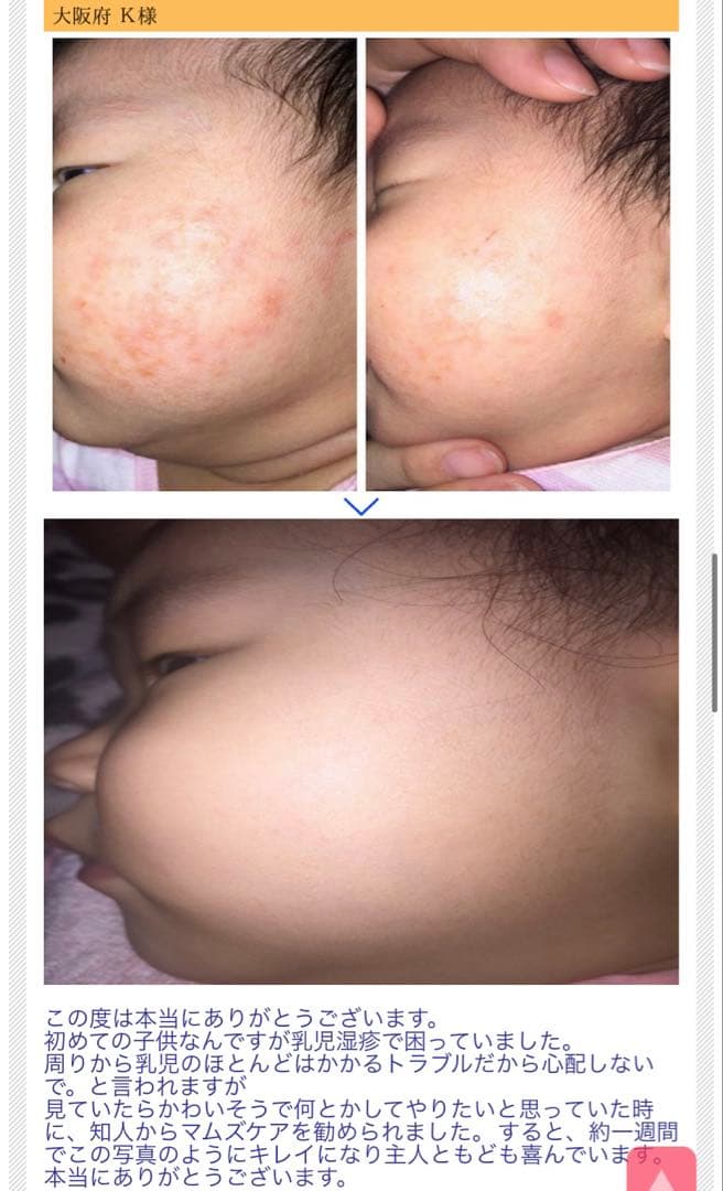 弱肌のあなたにおすすめ入浴剤⭐︎飲んでも◎ 弱肌のあなた