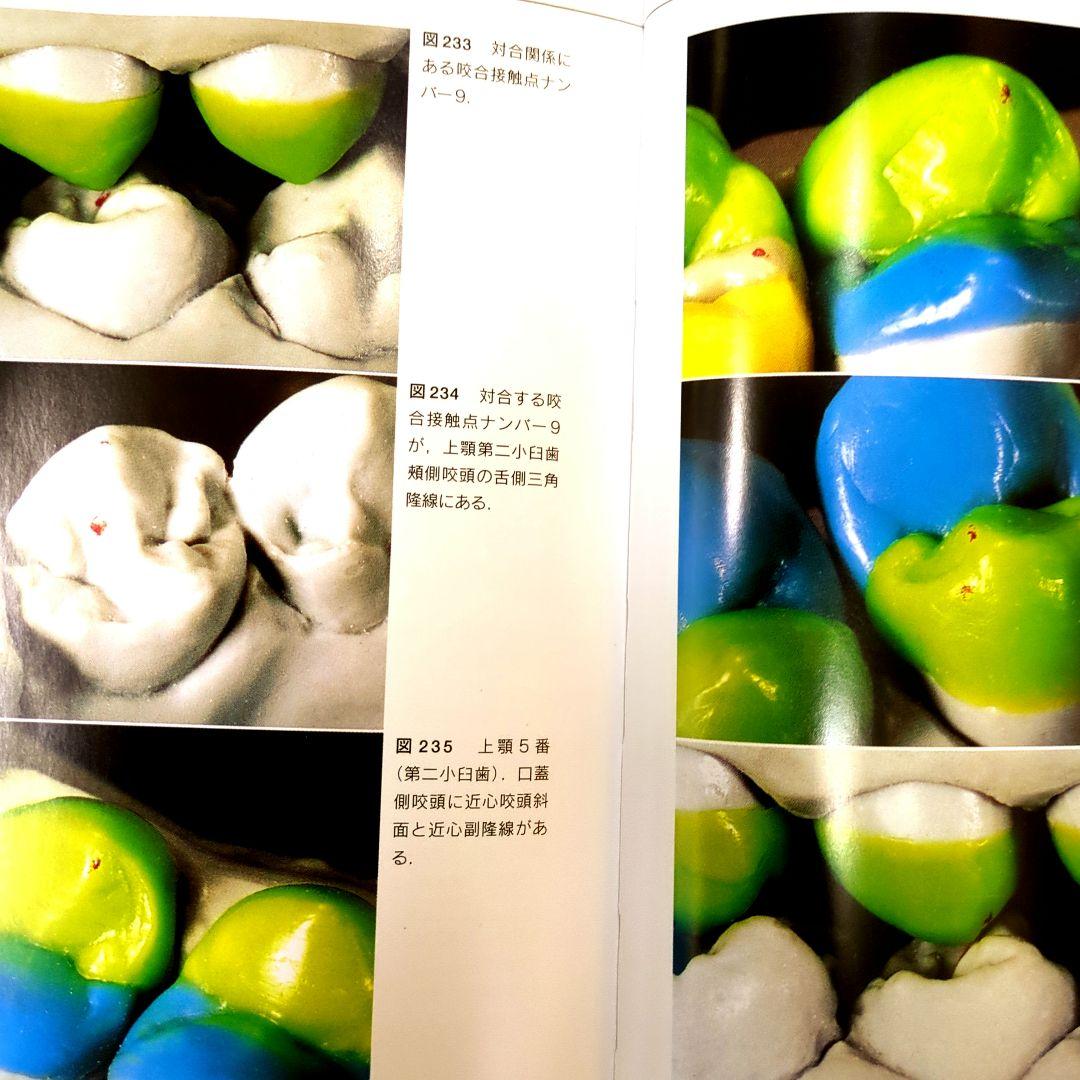 絶版) D.シュルツのワックスアップテクニック - メルカリ