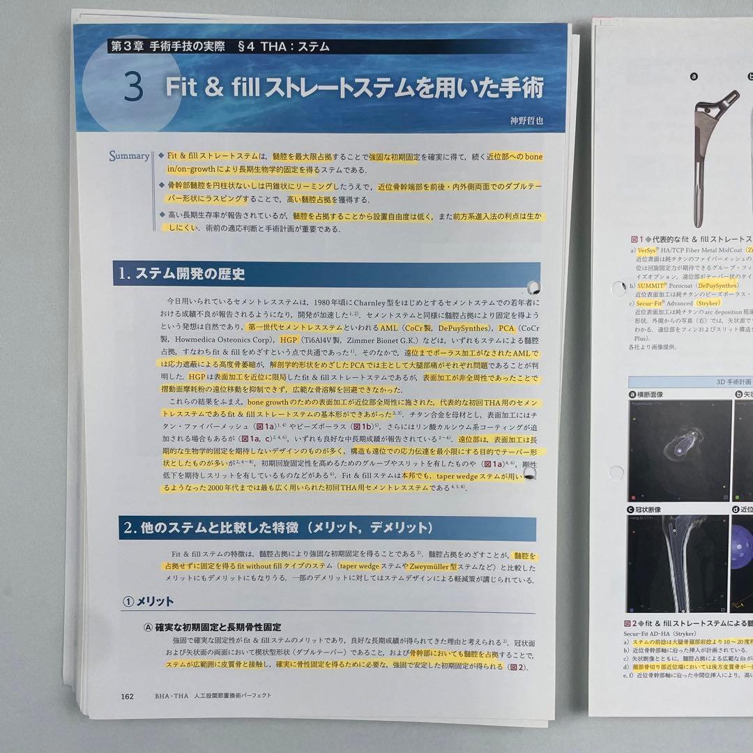 裁断済】BHA・THA 人工股関節置換術パーフェクト - メルカリ
