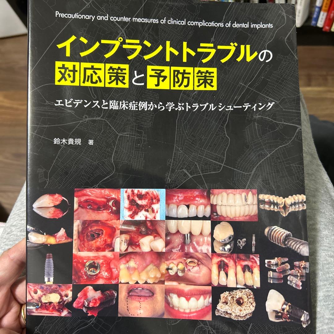 インプラントトラブルの対応策と予防策 81YFSkcopDL._AC_UF350,